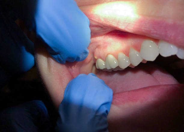 Best Cracked Tooth Emergency Dentist  in Mercersburg, PA