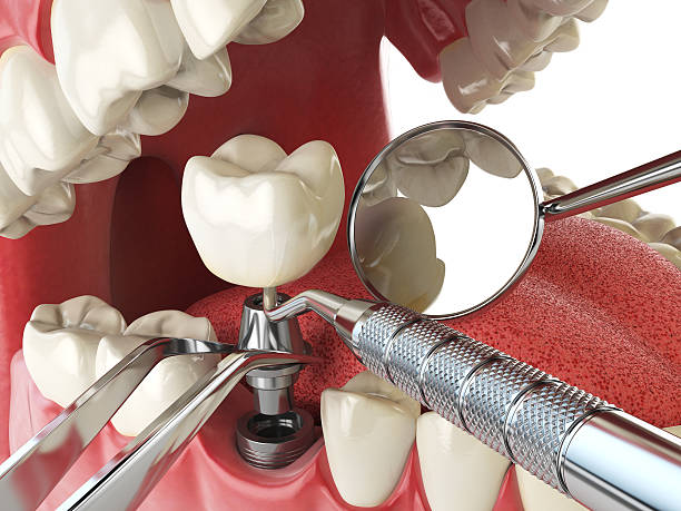 Best Broken Tooth Emergency  in Mercersburg, PA